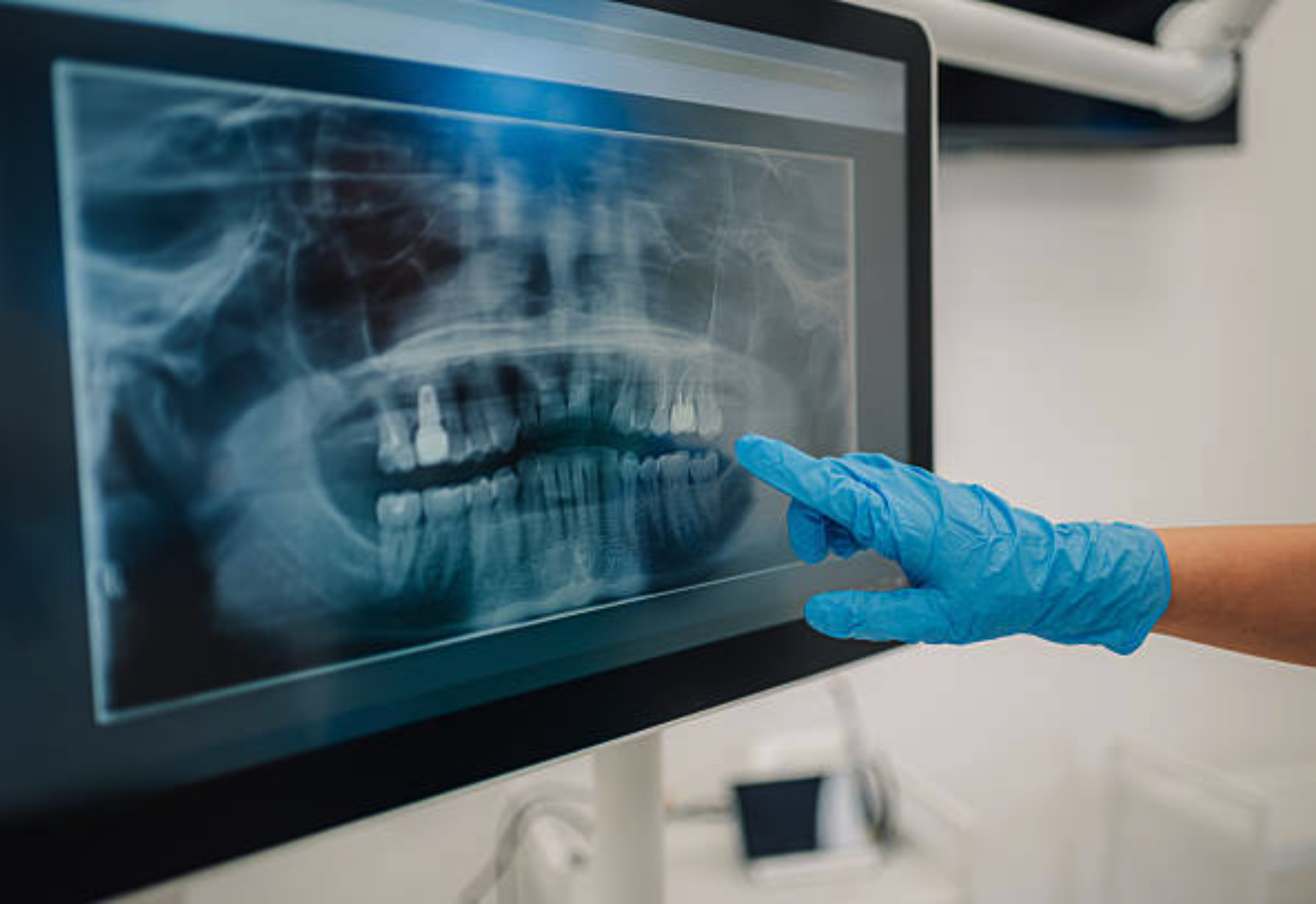 Why AI pilots never reach production